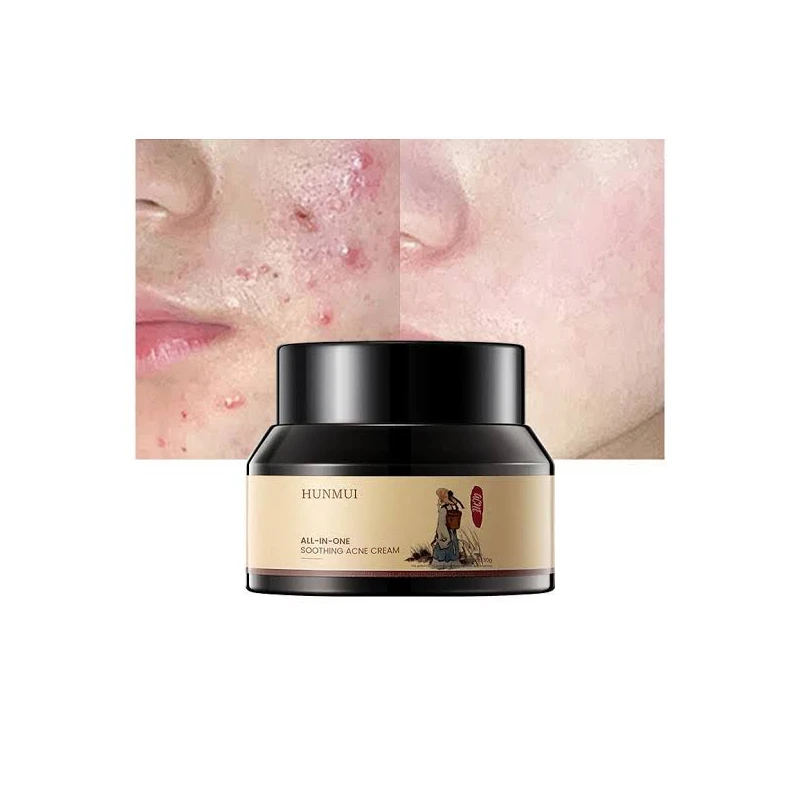 crm/additional_product_images/acne 2.webp